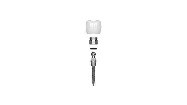 Mini Dental Implants East Longmeadow Dental Dental Implants in MA