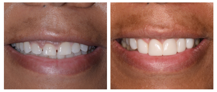 Bioclear in East Longmeadow, MA | Dr. Gregory Zirakian