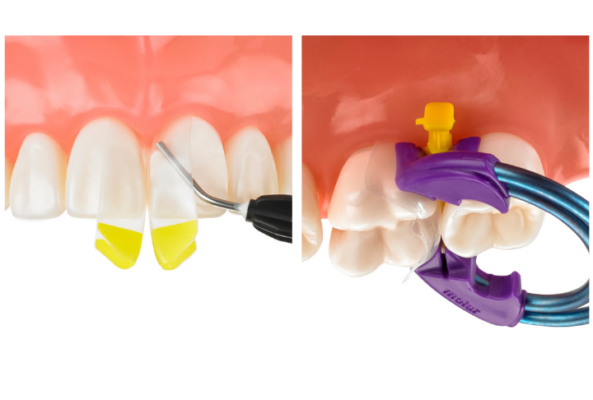 Bioclear in East Longmeadow, MA | Dr. Gregory Zirakian
