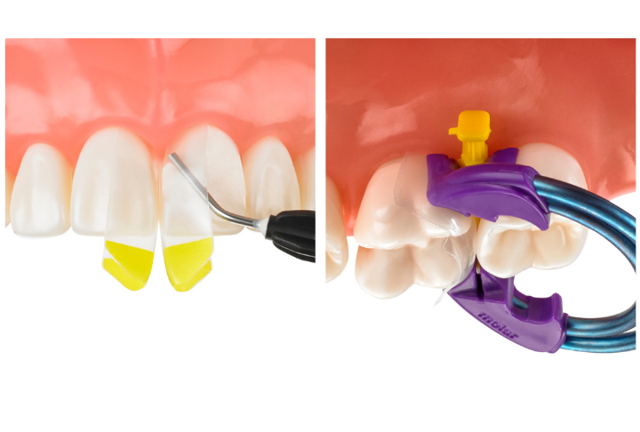 Bioclear in East Longmeadow, MA | Dr. Gregory Zirakian