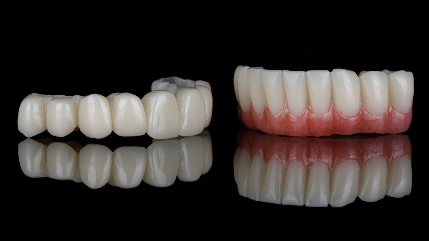 Denture Options In East Longmeadow MA Mini Implant Dentures   Denture Options In East Longmeadow MA Mini Implant Dentures 1400x788 