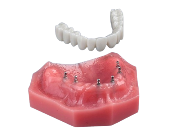 Denture Option in East Longmeadow, MA | Free Consultations