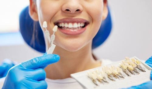 Porcelain Veneers Process in East Longmeadow MA | Free Consultations