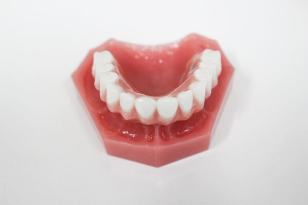 Snap In False Teeth in East Longmeadow, MA | Free Consultations