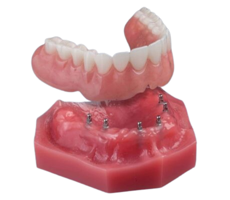 Snap-In Denture in East Longmeadow, MA | Free Consultations