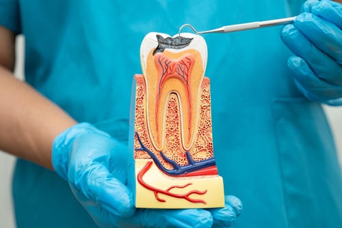 Root Canal Crown [Video FAQ]  Save Your Tooth From Extraction